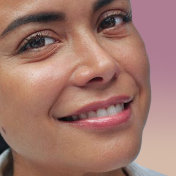 AMS main Juvederm Ultra Plus