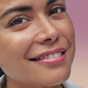 AMS main Juvederm Ultra Plus.jpg