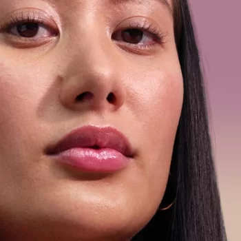 AMS main Juvederm Ultra.jpg