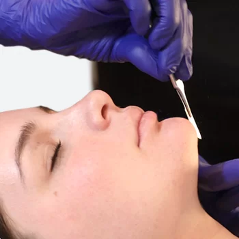 AMS main dermaplaning 1.jpg