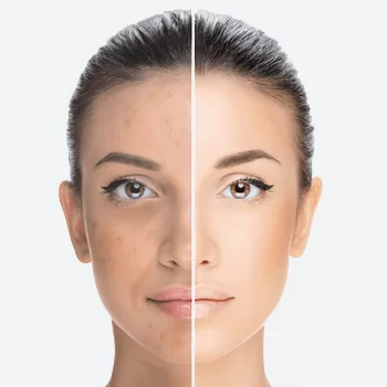 AMS main ipl.jpg (1)