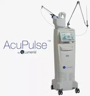Acupulse machine.jpg