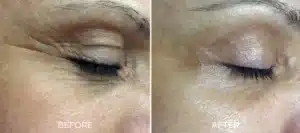Glo2Facial BA eye 2048x910.jpg