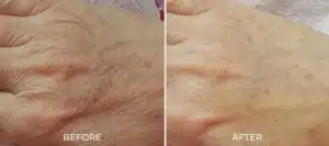 Glo2Facial BA hand 2048x910.jpg