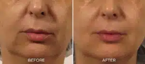 Glo2Facial BA mouth 2048x910.jpg