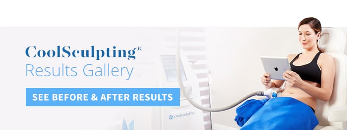 View Gallery Coolsculpting 2 (1)