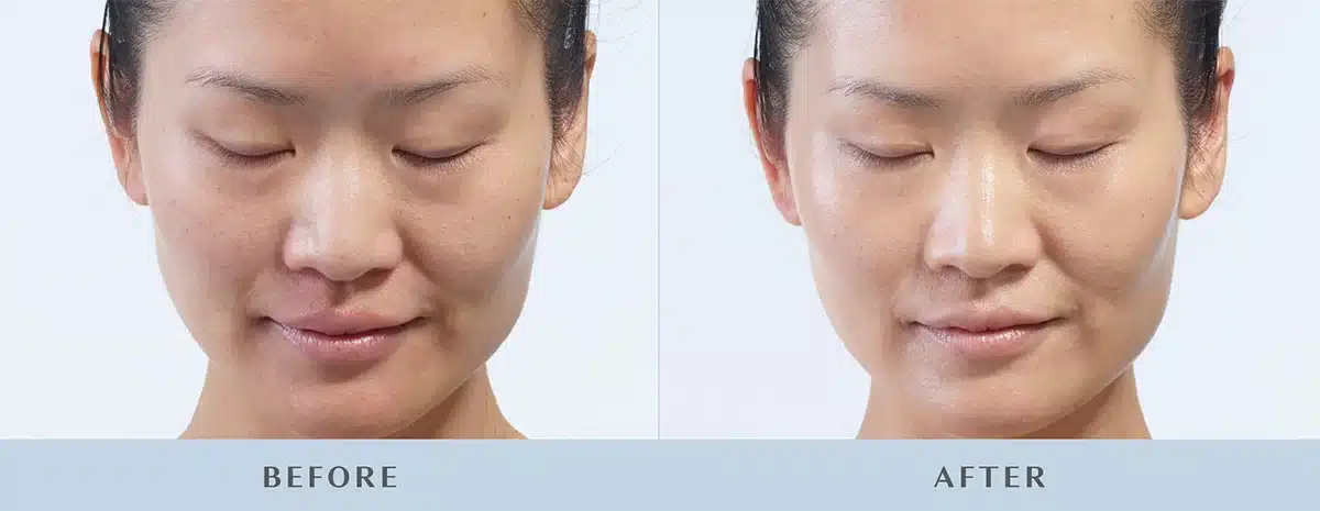 instant results diamondglow.jpg