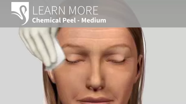 3D Video Chemical Peel Medium