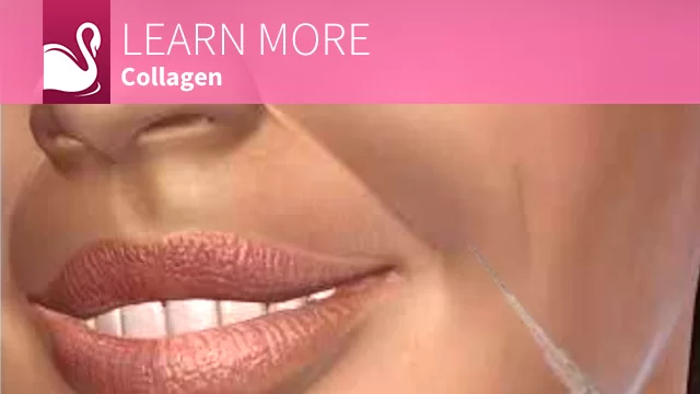 3D Video Collagen.jpg