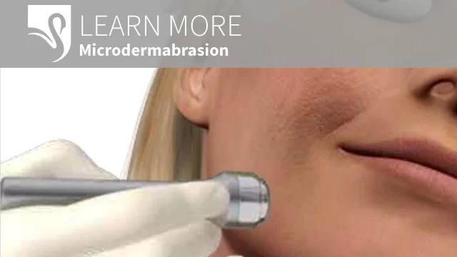 3D Video Microdermabrasion.jpg